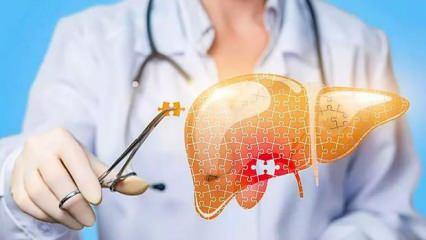 Doğal yollarla karaciğer temizliği: Karaciğeri en hızlı temizleyen 6 altın öneri! 