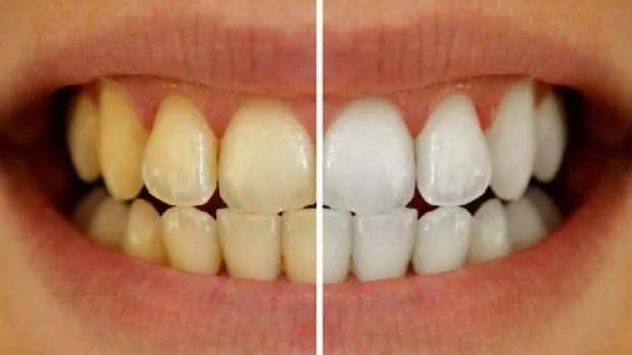 Dişleri bembeyaz yapmak bu kadar kolay! Kırmızı renginin aksine beyazlatan etki!